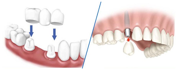 Nha khoa Art Dentist hạn chế tối đa sự tổn thương và cảm giác khó chịu cho khách hàng.