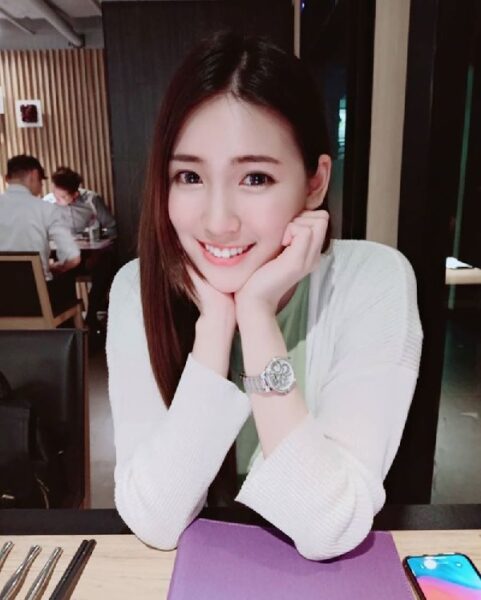 Làm răng thỏ là gì ? Thế nào là răng thỏ đẹp