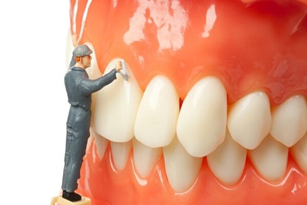 Địa chỉ lấy cao răng tốt, uy tín, không ảnh hưởng men răng