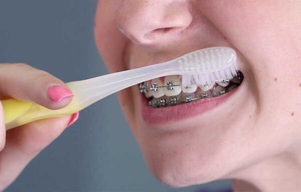 Bạn nên chải răng nhẹ nhàng, sử dụng nước súc miệng và chỉ nha khoa